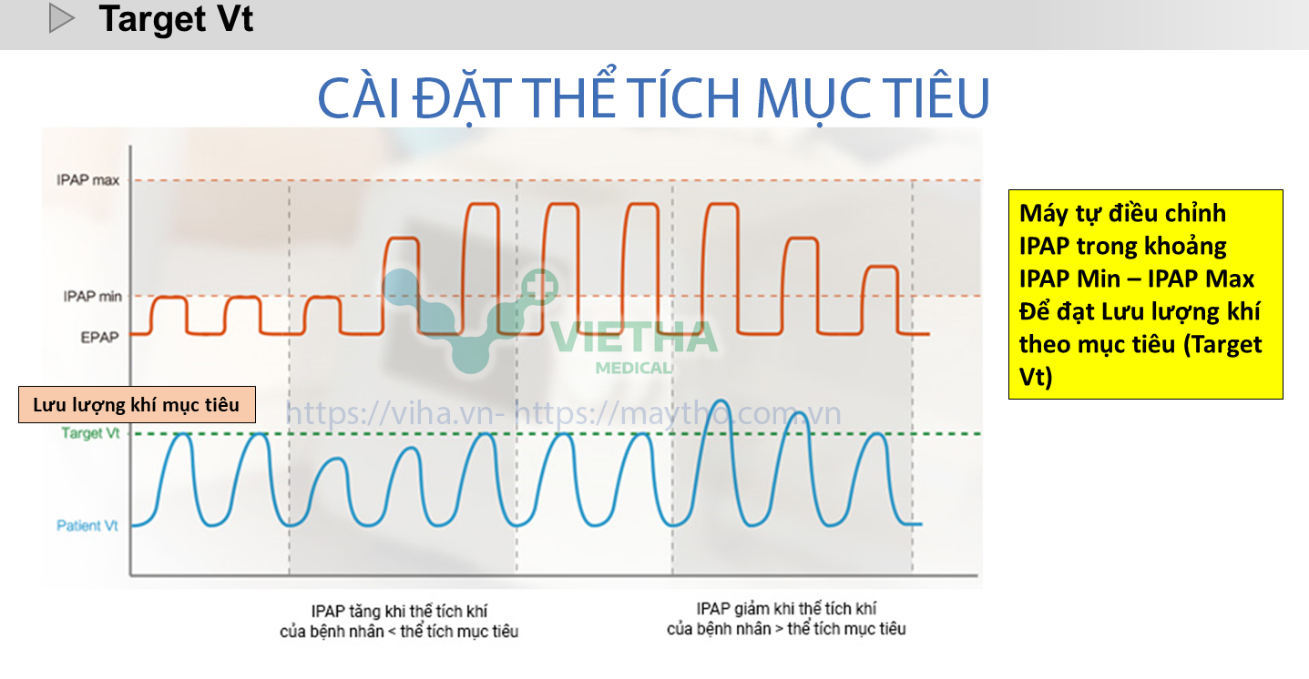 Lựa chọn Mode thở phù hợp với tình trạng bệnh