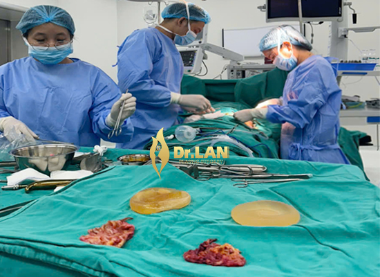 TS.BS. Hoàng Lan đang trực tiếp thực hiện phẫu thuật trong phòng mổ vô khuẩn hiện đại