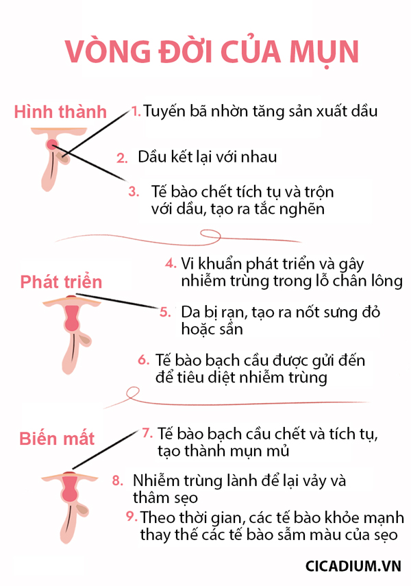 Vòng đời của mụn