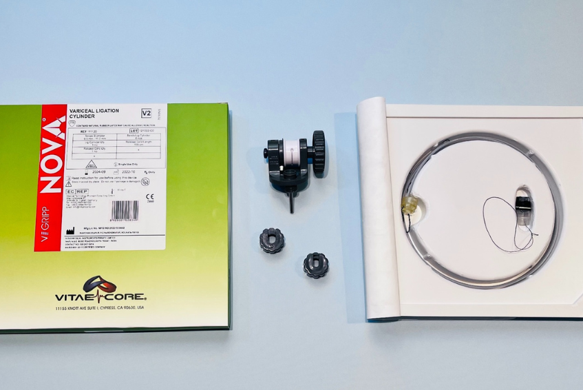 Thắt tĩnh mạch thực quản