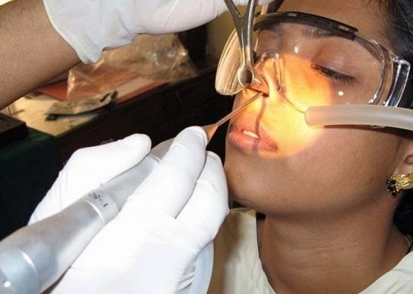 Phẫu thuật nội soi mũi xoang là phương pháp hiện đại không xâm lấn cơ thể