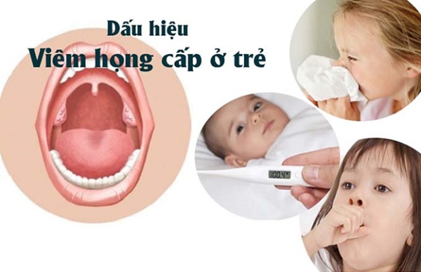 Những biểu hiện viêm mũi họng cấp ở trẻ em