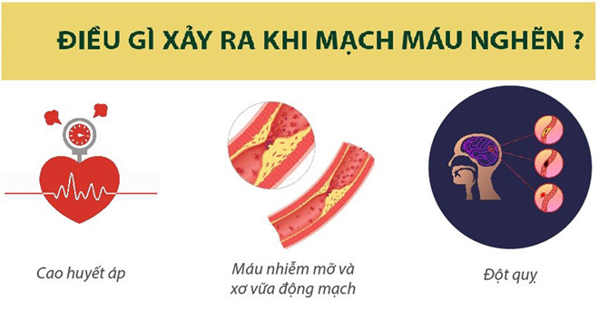 Hậu quả xảy ra khi bị nghẽn mạch máu
