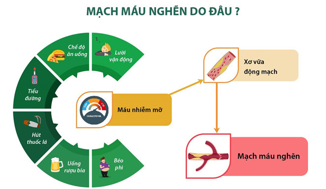 Nguyên nhân gây nghẽn mạch máu