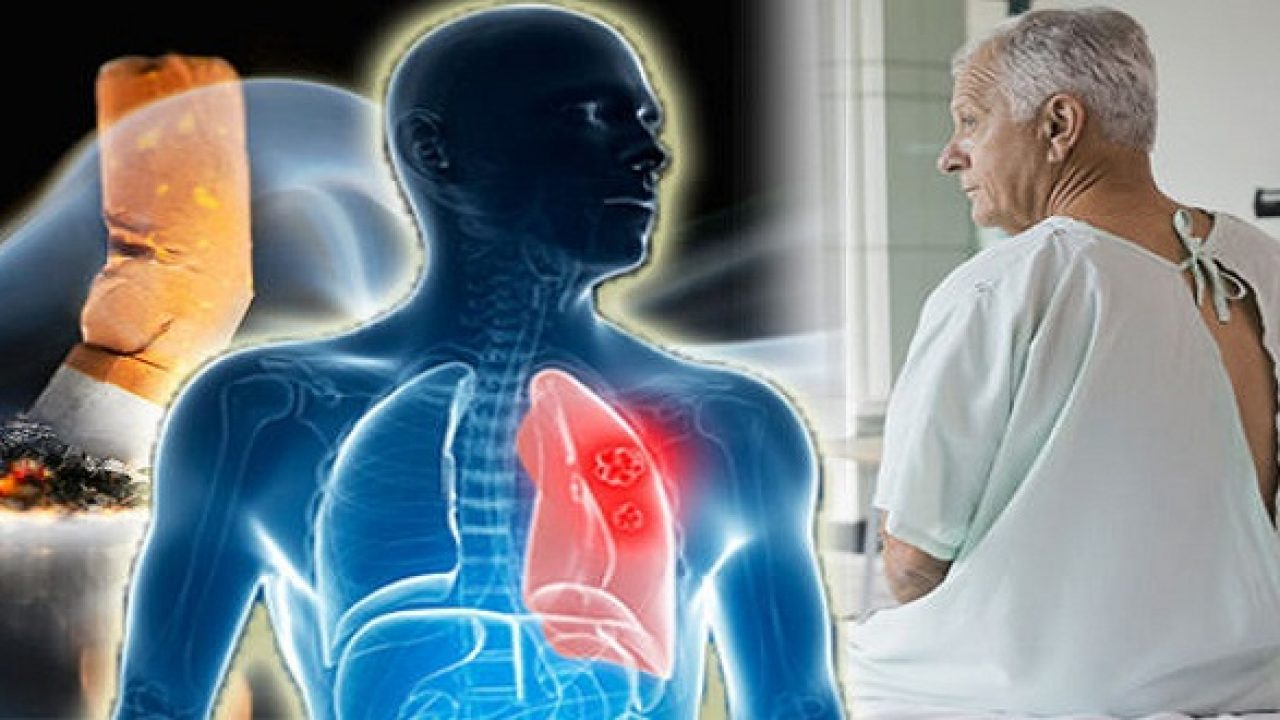 trà xanh giảm nguy cơ ung thư phổi