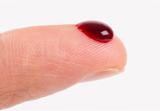 Tay mình bị dính máu