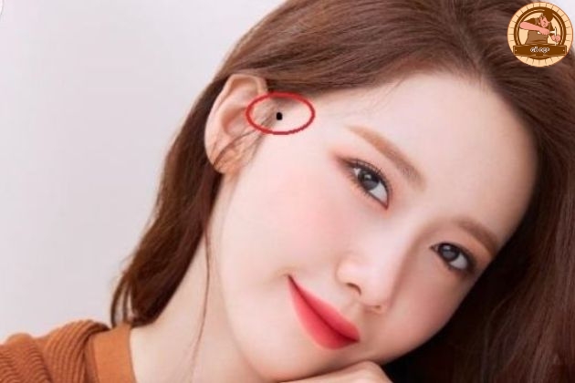 Nốt ruồi gần xoáy tóc điềm báo tốt hay xấu