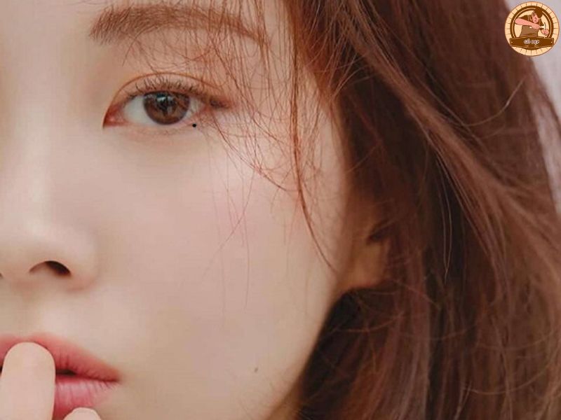 Nốt ruồi đón lệ là gì?