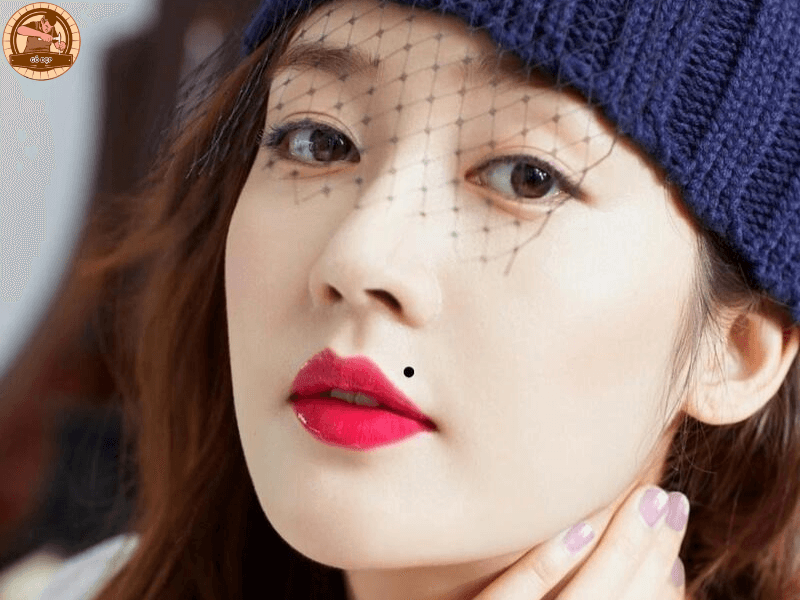 Nốt ruồi khóe miệng trên bên trái