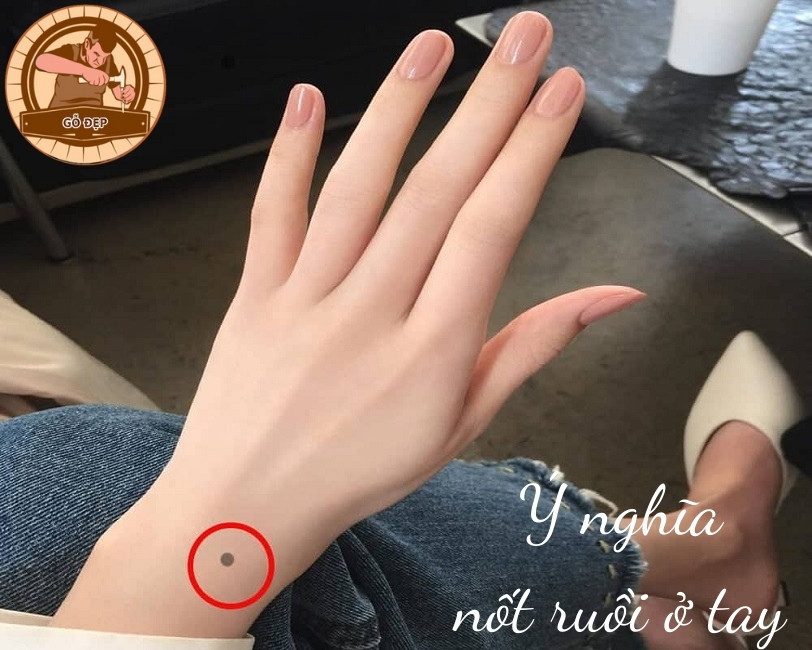 Nốt ruồi trên cánh tay nam, nữ có ý nghĩa gì