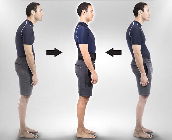 Tìm hiểu về tình trạng gù lưng