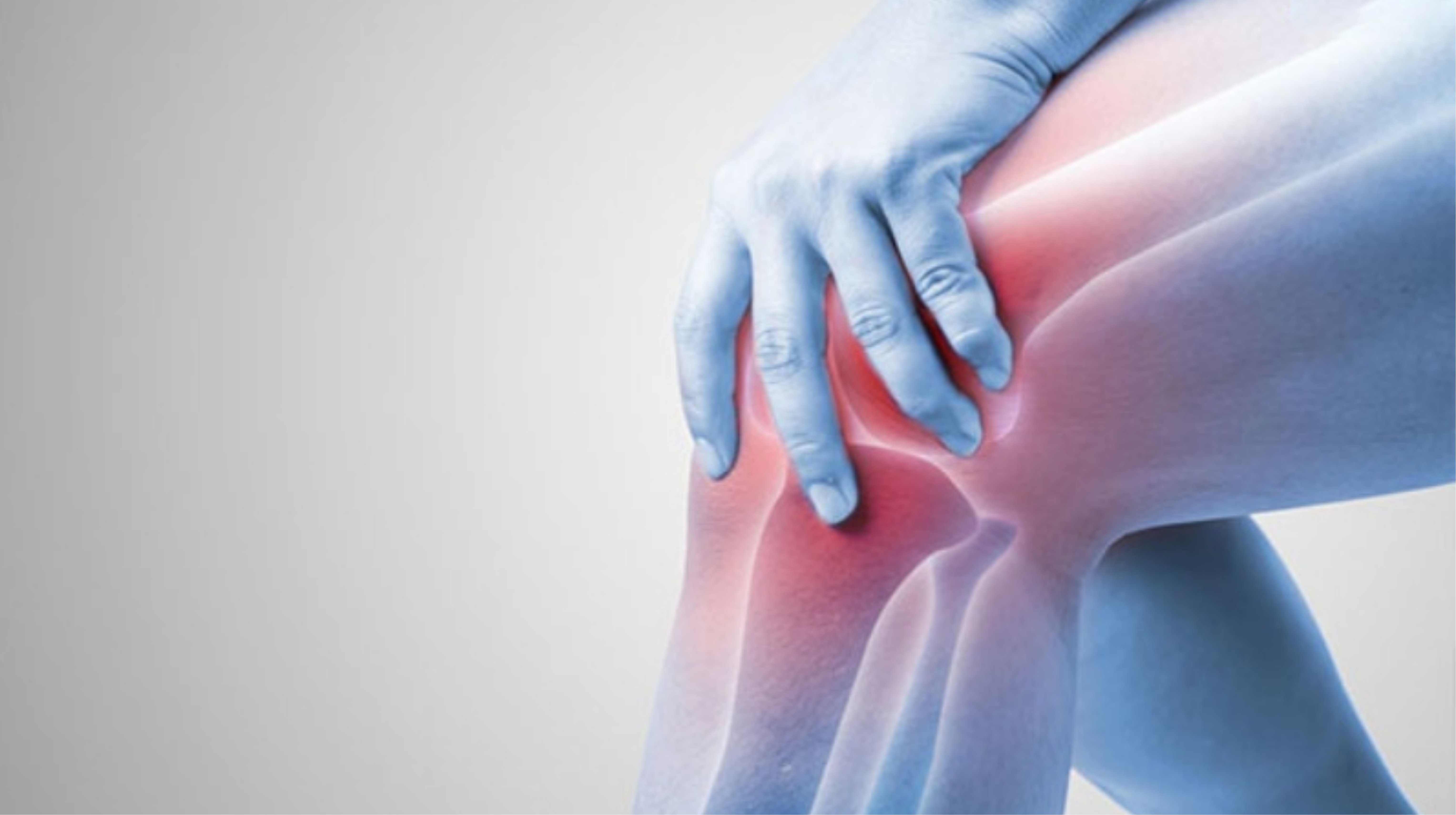 Curcummin hỗ trợ bệnh viêm xương khớp