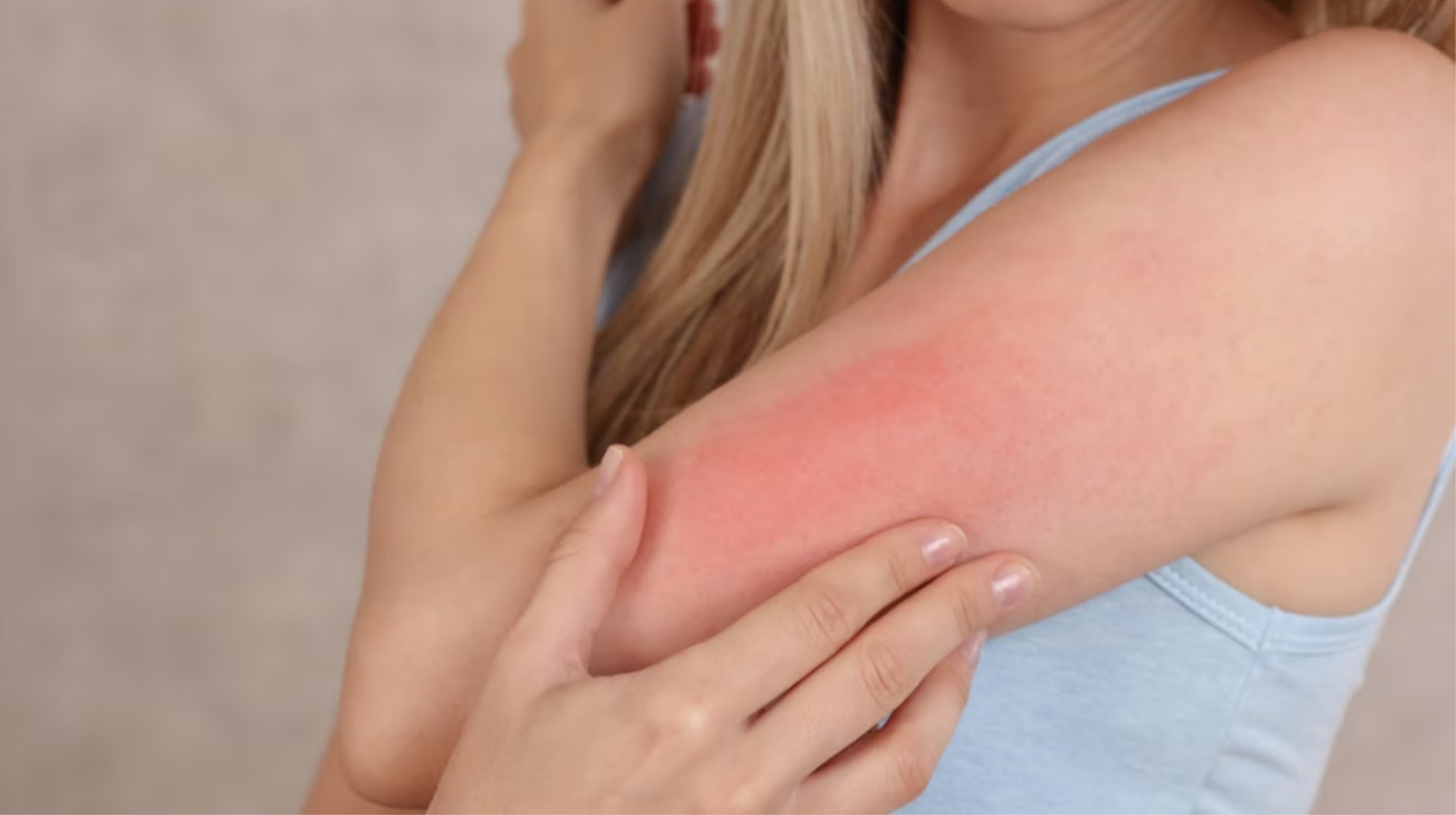 Một số người gặp phản ứng khi dùng NMN do sự khác biệt về cơ địa