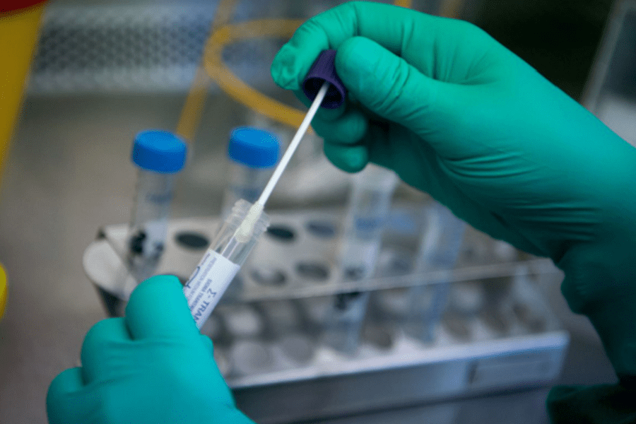 bộ kit test covid dễ sử dụng