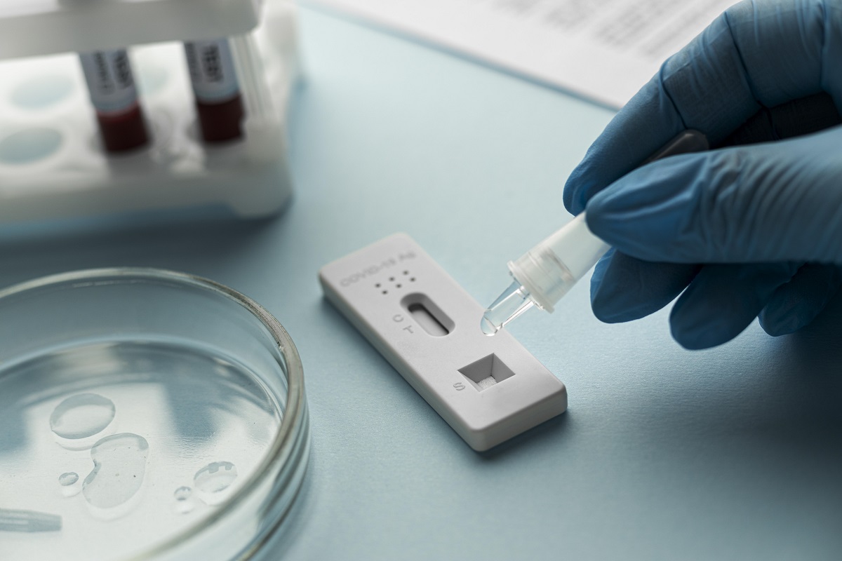 vì sao nên sử dụng bộ kit test covid
