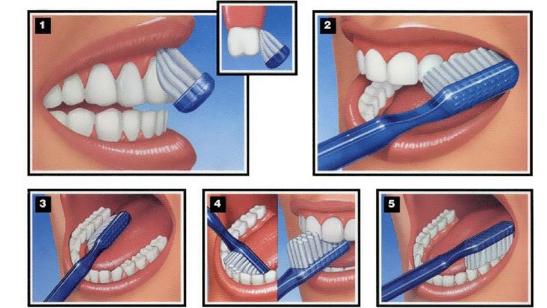 Chăm sóc răng miệng bằng việc chải răng đúng cách