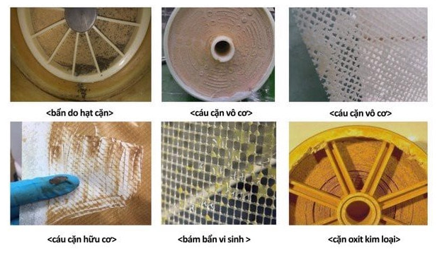 Các dạng cáu cặn thường gặp