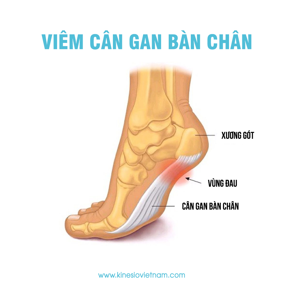 Viêm gan bàn chân