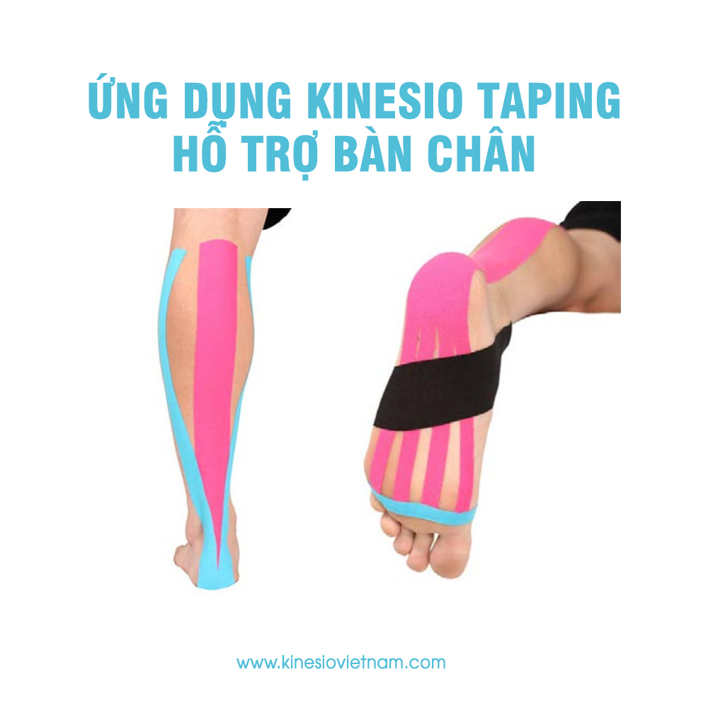 Ứng dụng Kinesio Taping