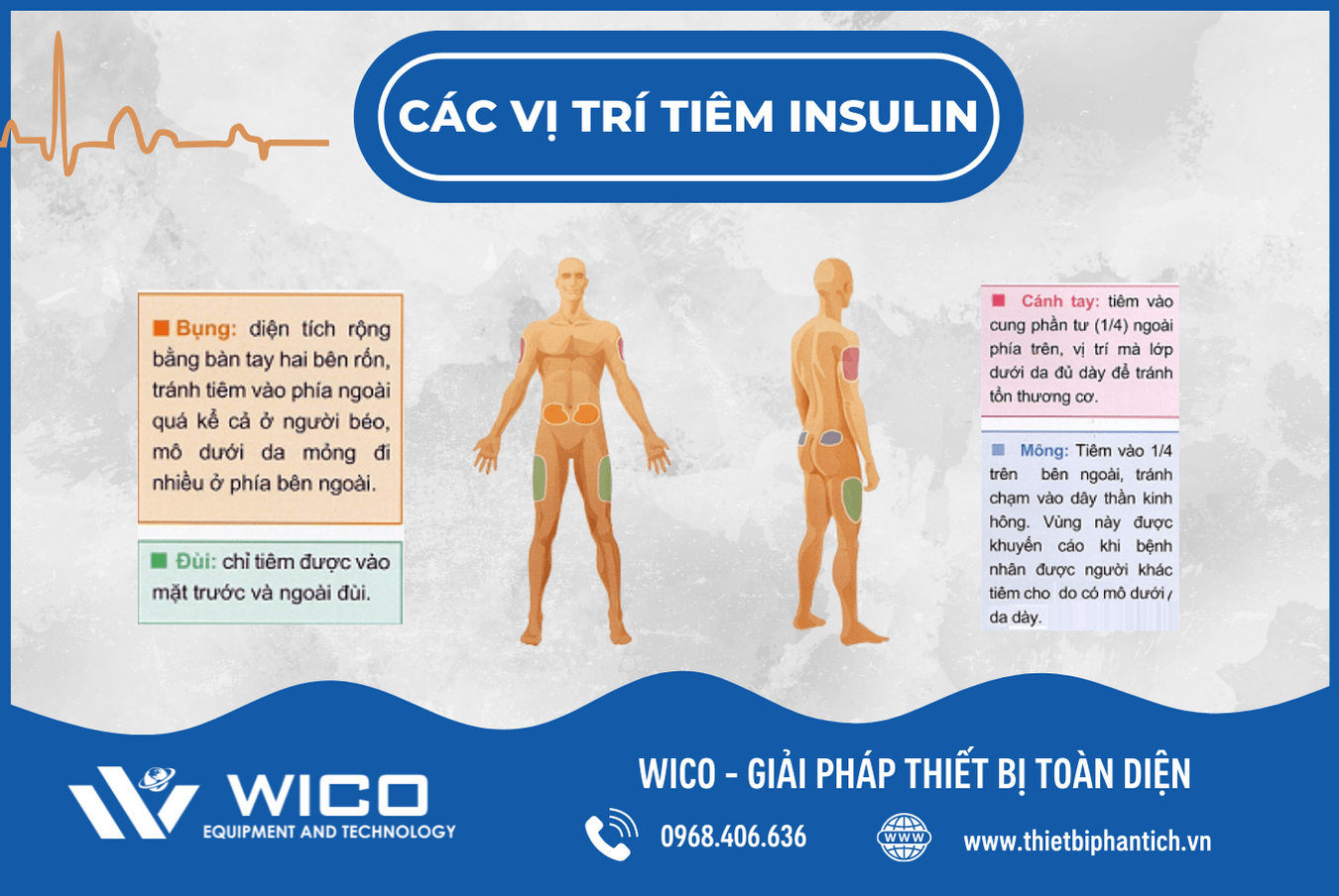 Các vị trí tiêm Insulin