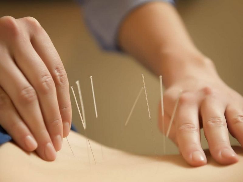 cham cuu chua thoai hoa cot song