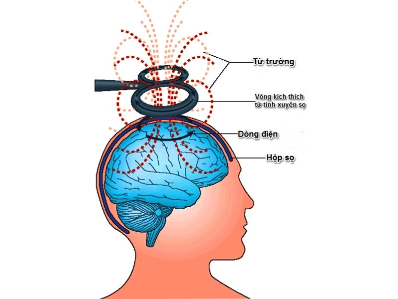 cach thuc hoat dong cua phuong phap kich thich tu truong xuyen so
