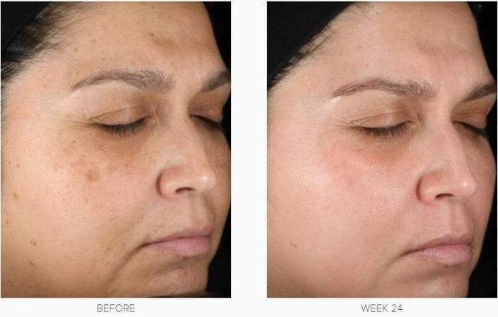 Obagi Retinol 1.0 Cream