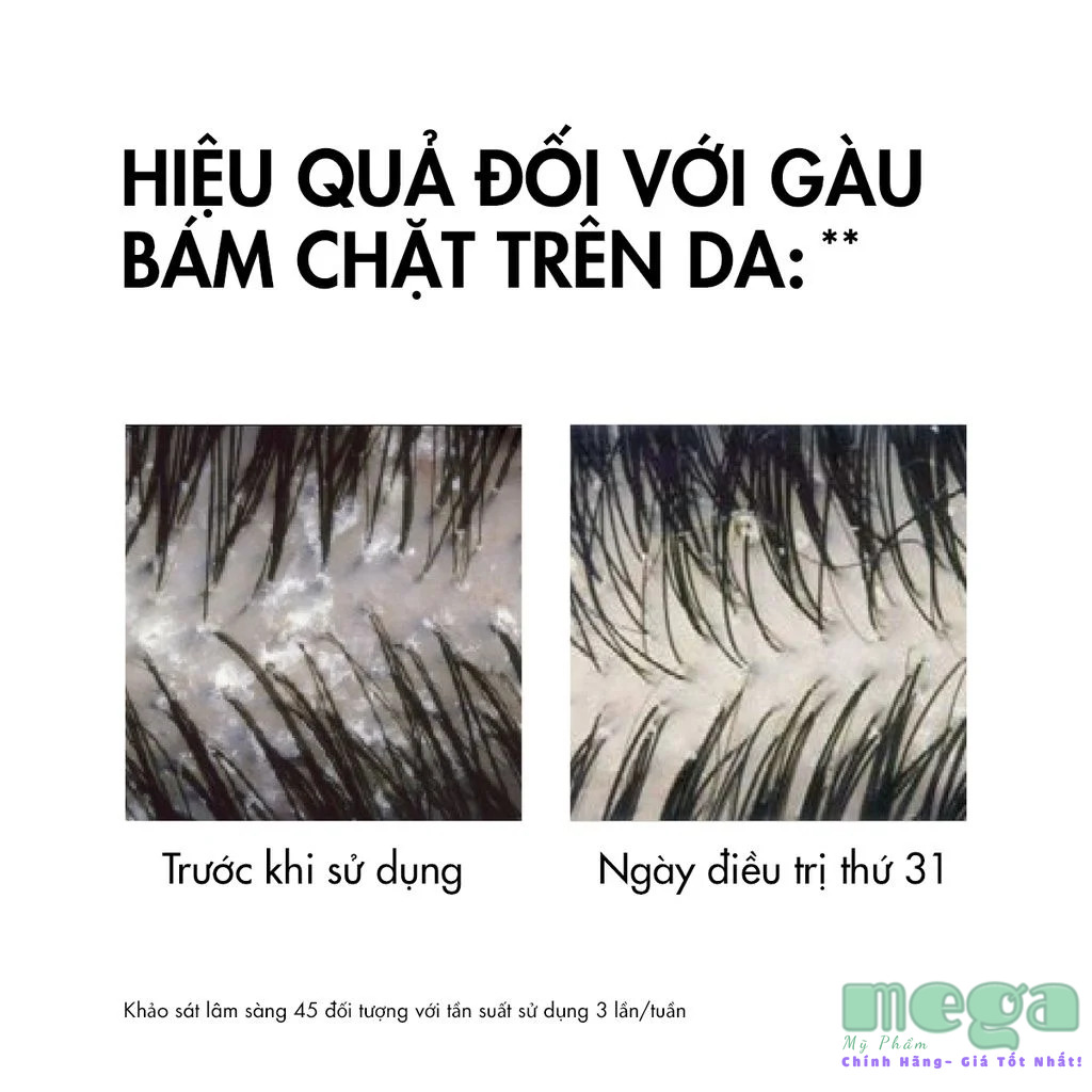 Dầu gội Vichy Dermatological Shampoo