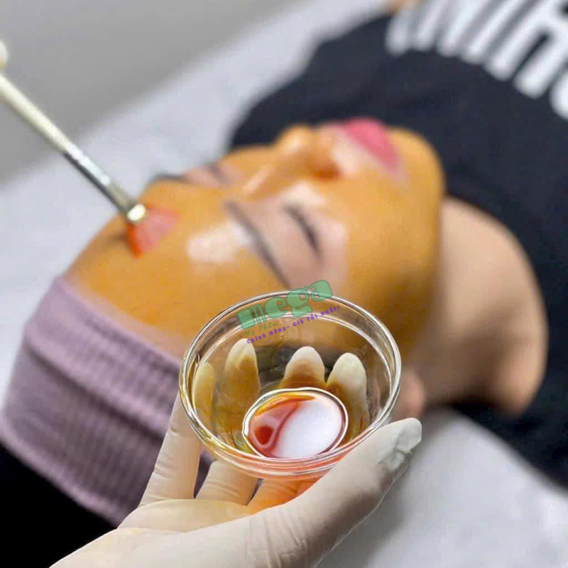 Mesoestetic Mesopeel MD Retiflash