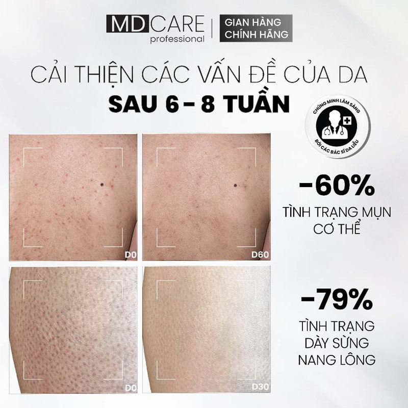 Sữa Tắm MD CARE AHAs & BHA Exfoliating Body Wash