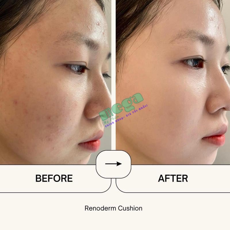 RENODERM Daylong BB Cream Cushion