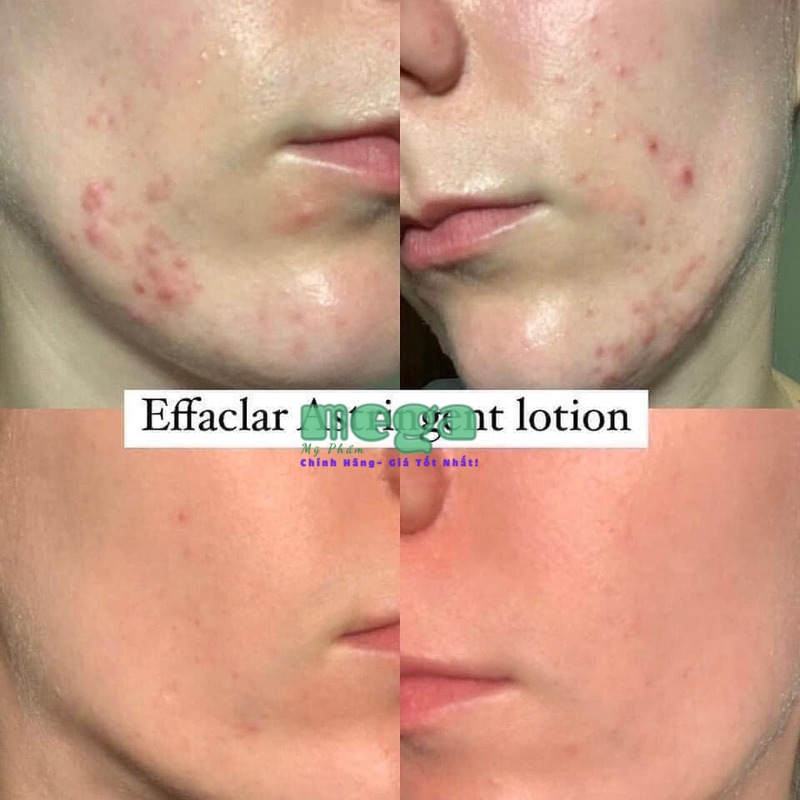 La Roche Posay Effaclar Toner