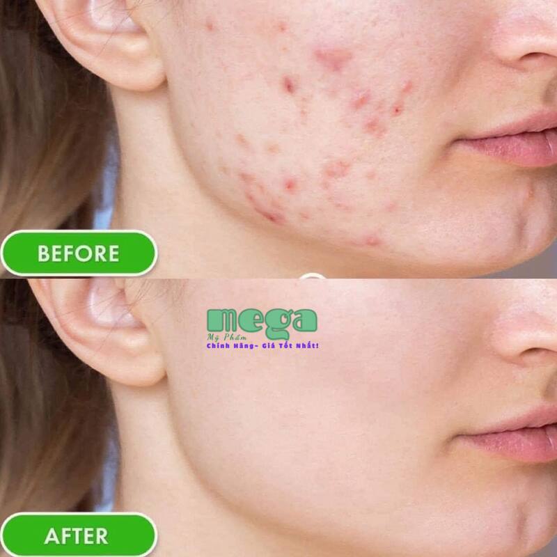 SVR Sebiaclear Active Cream