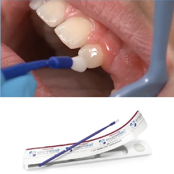 Que bôi chống sâu răng Vecni Flour Enamelast nuốt được cho bé 2 tuổi