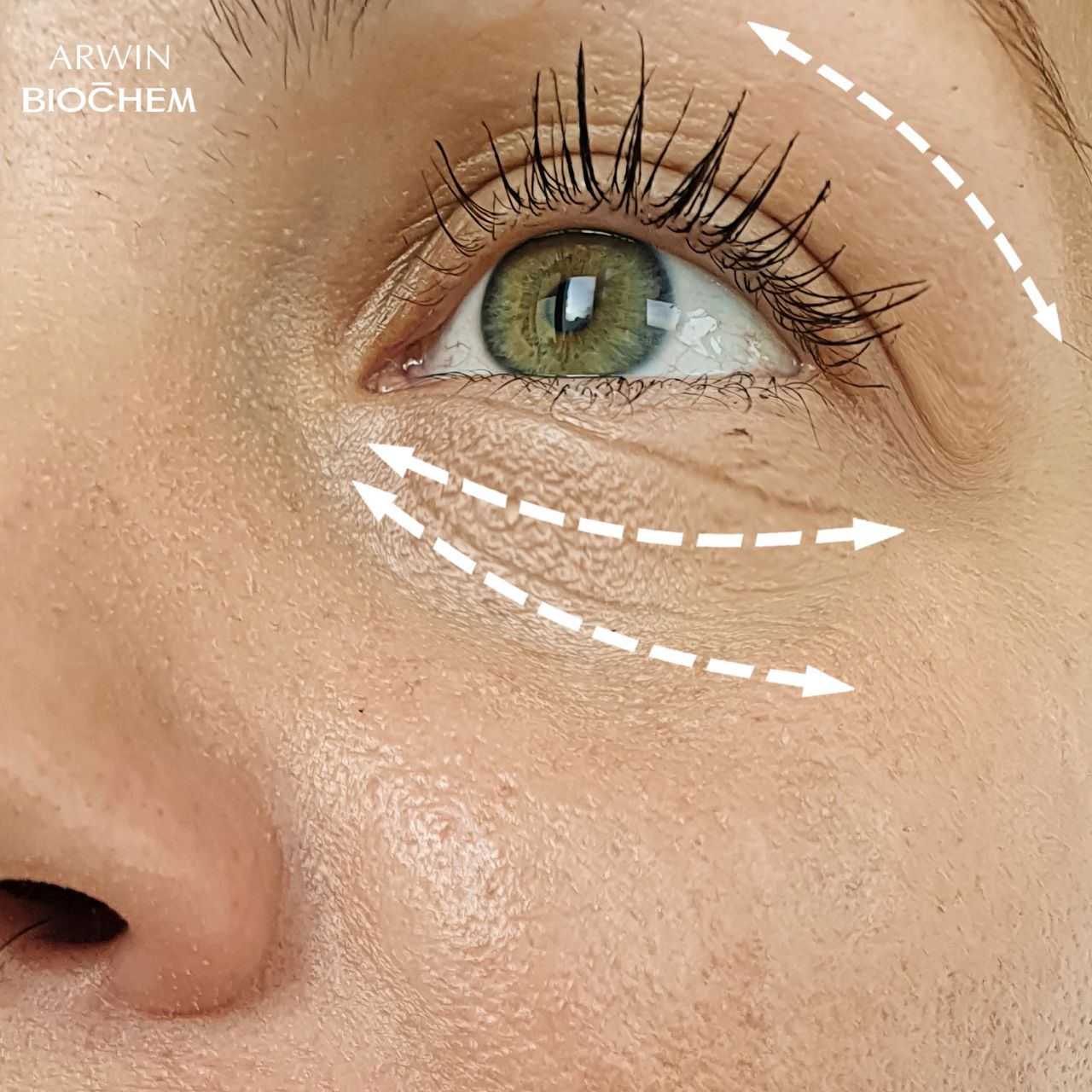 Vùng da quanh mắt bị lão hóa