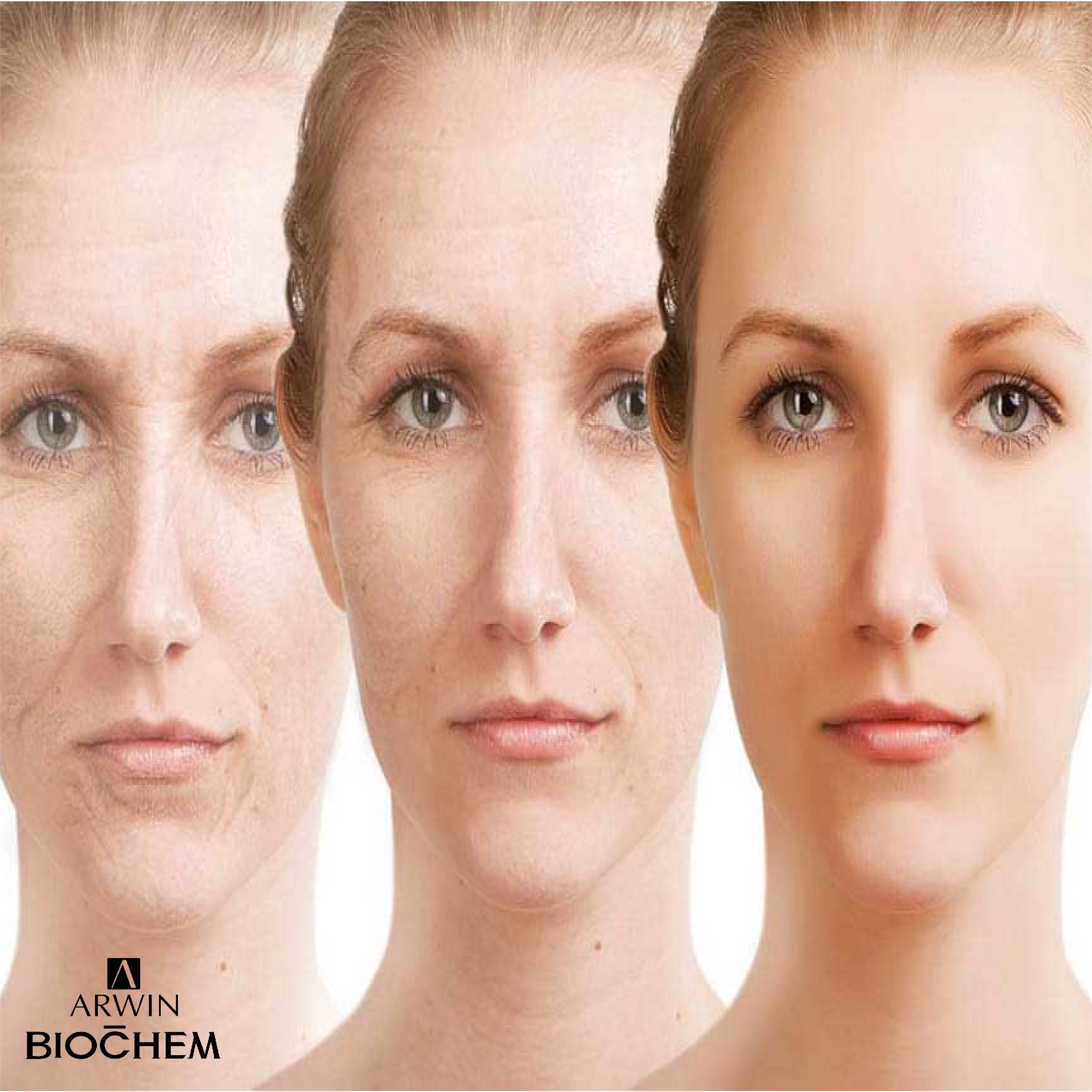 nguyên nhân gây lão hóa da