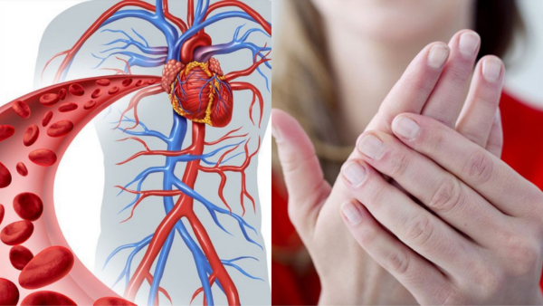 Nguyên nhân đau cơ xương khớp có thể do kém lưu thông máu