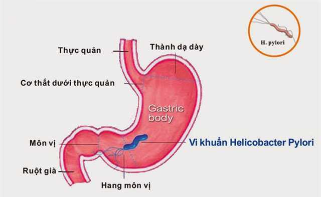 Chè Dây - Trà Dây | Địa chỉ bán chè dây điều trị bệnh dạ dày