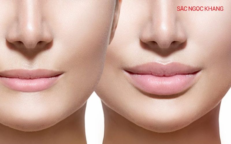 Có thể điều chỉnh lượng collagen để đạt được kết quả mong muốn