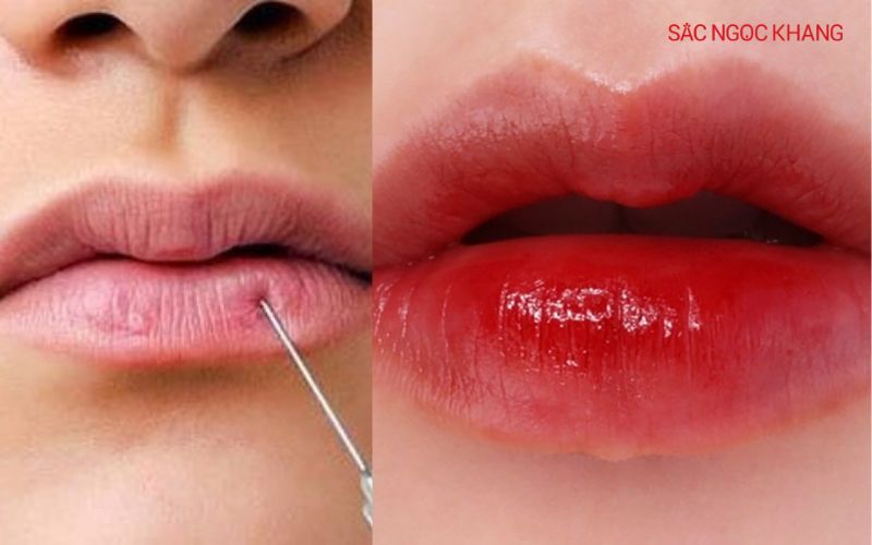 Môi cherry