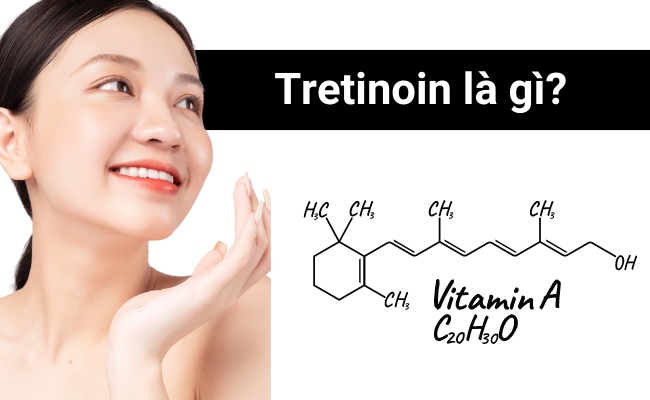 Tretinoin là dẫn xuất của Vitamin A