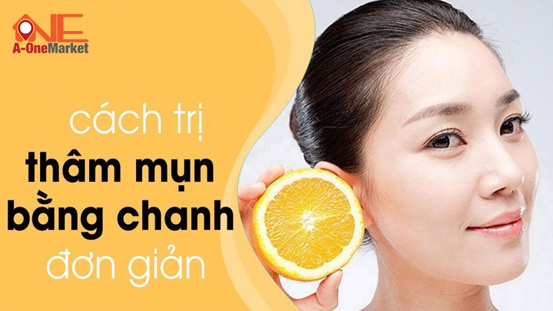 Cách trị thâm mụn bằng chanh