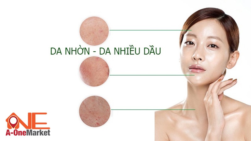 Da dầu khiến da mặt da luôn bóng loáng, lỗ chân lông to