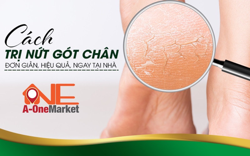 Mẹo trị nứt gót chân đơn giản ngay tại nhà