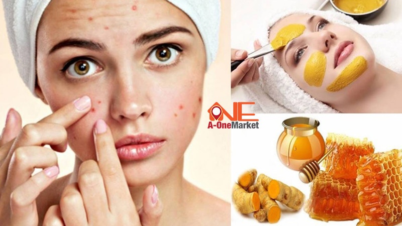 Trị thâm mụn bằng mật ong và nghệ