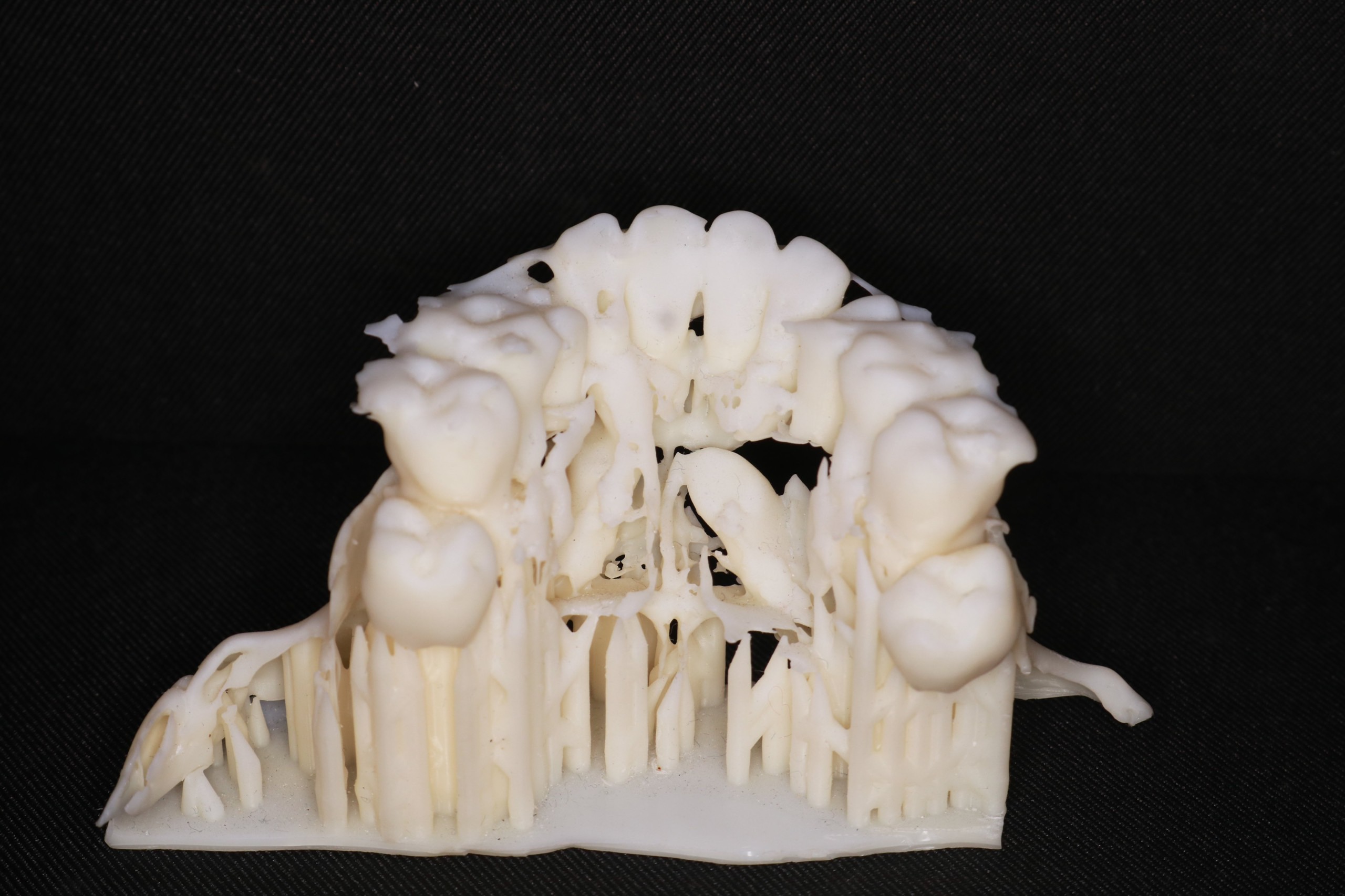 Dịch vụ làm khay duy trì sau chỉnh nha