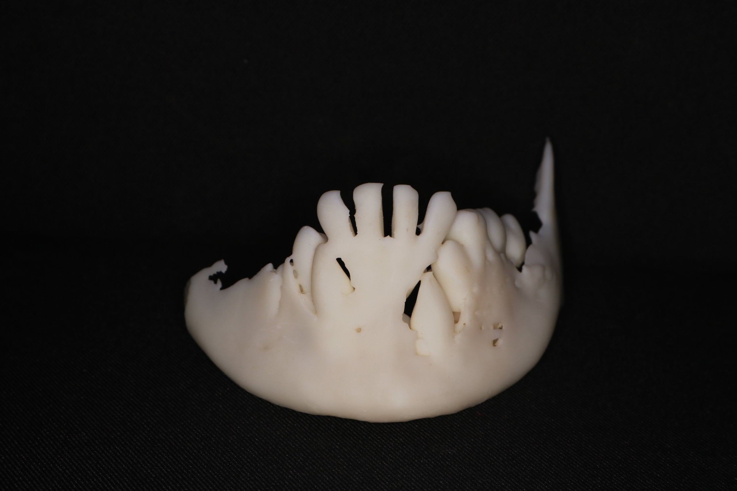 Dịch vụ làm khay duy trì sau chỉnh nha