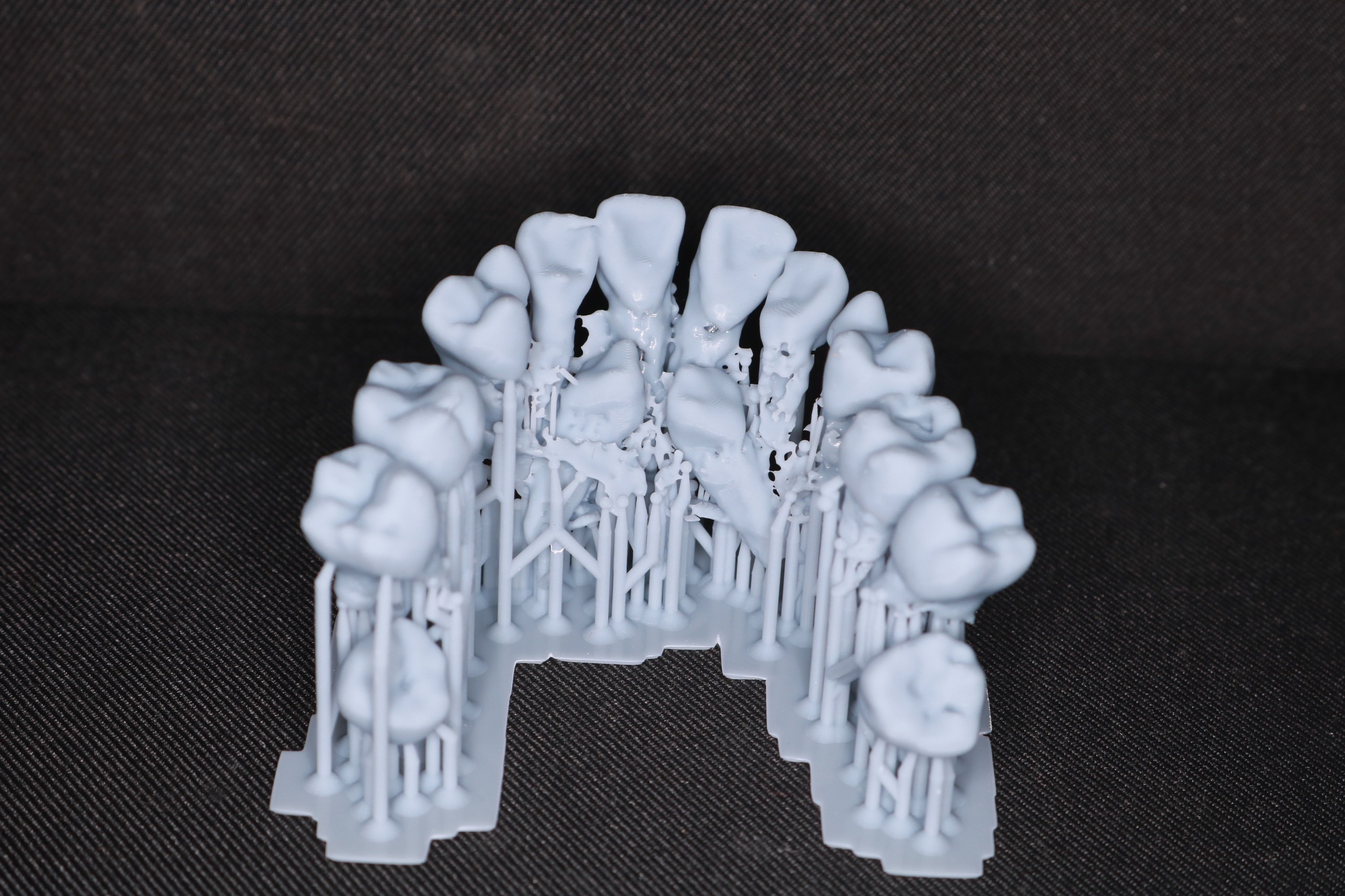 Dịch vụ làm khay duy trì sau chỉnh nha