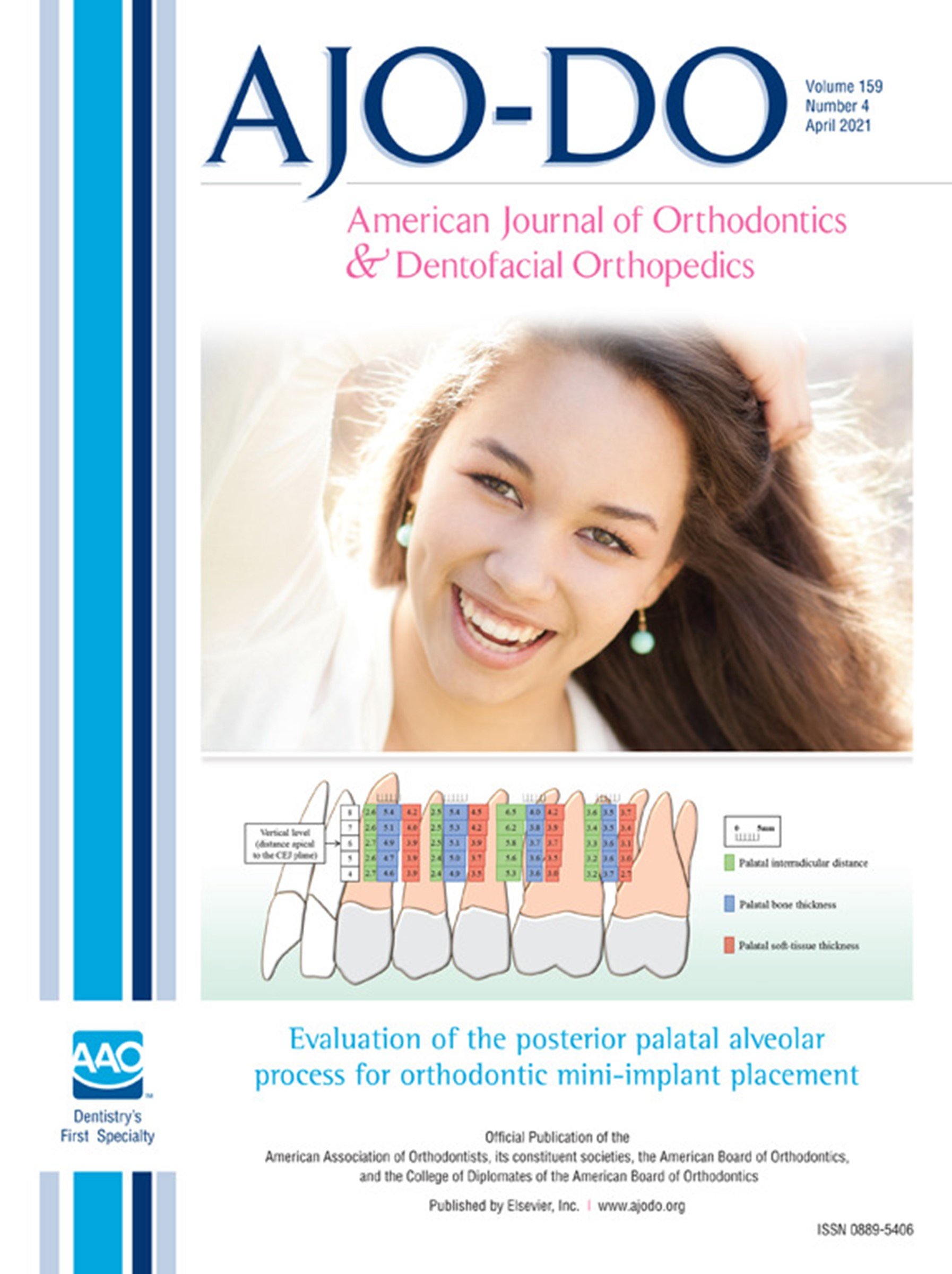 Evaluation of the posterior palatal alveolar process for orthodontic mini-implant placement