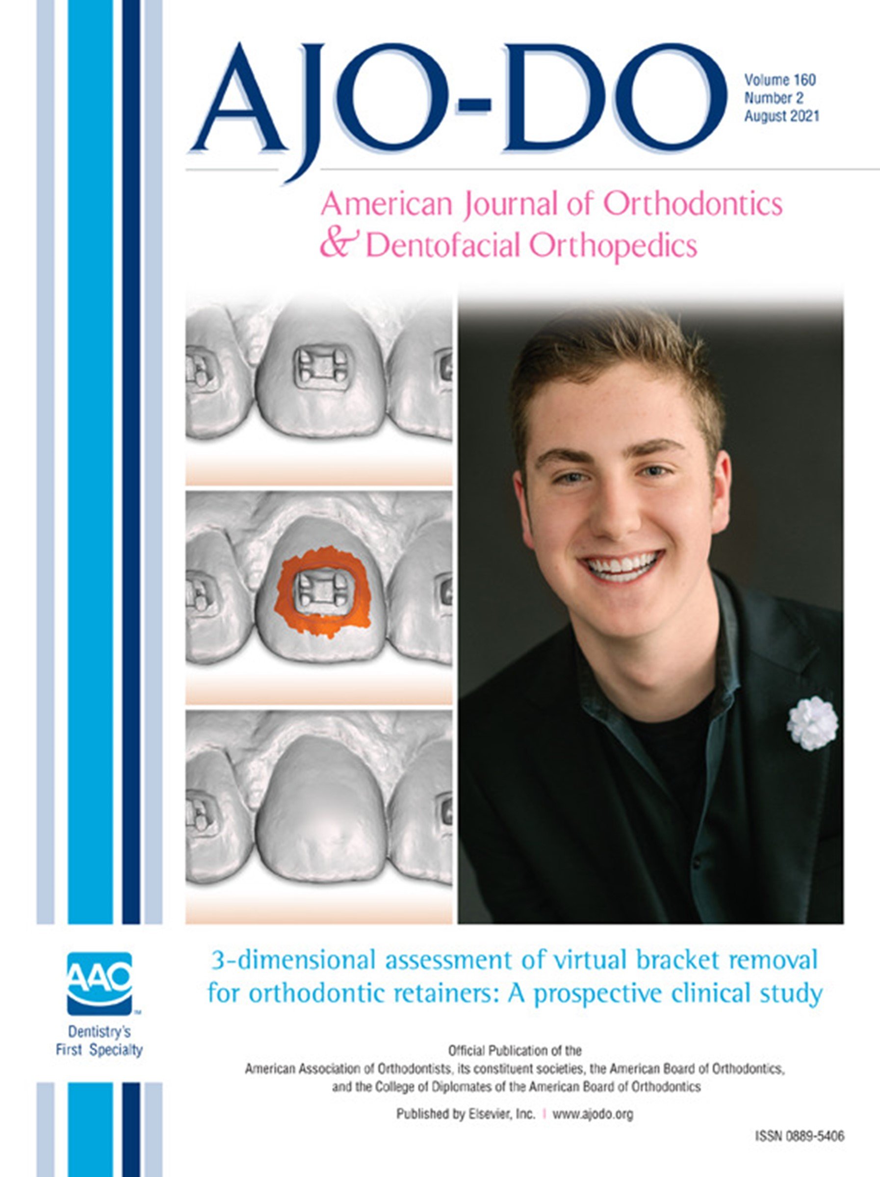 3-dimensional assessment of virtual bracket removal for orthodontic retainers: A prospective clinical study